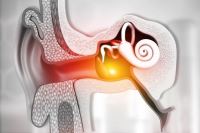 سمعک در اصفهان