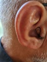 سمعک در اصفهان