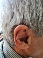 سمعک در اصفهان