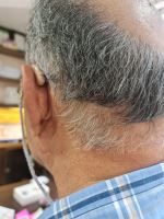 سمعک در اصفهان