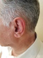 شنوایی سنجی در اصفهان