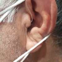 سمعک در اصفهان