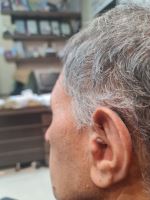 شنوایی سنجی در اصفهان