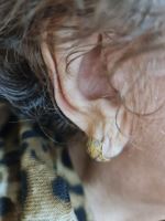 شنوایی سنجی در اصفهان