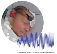 بهترین سمعک اصفهان