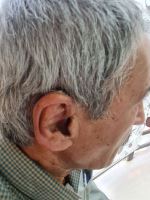 بهترین سمعک اصفهان