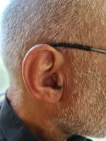 بهترین سمعک اصفهان