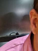 بهترین نمایندگی سمعک