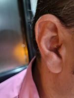 بهترین نمایندگی سمعک