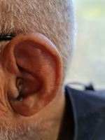 سمعک زیمنس در اصفهان