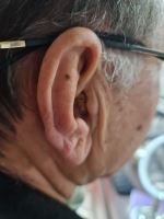 سمعک زیمنس در اصفهان