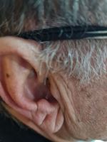 سمعک زیمنس در اصفهان