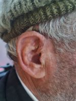 کلینیک شنوایی در اصفهان