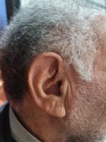 کلینیک شنوایی در اصفهان