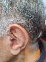 کلینیک شنوایی در اصفهان