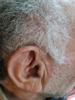 کلینیک شنوایی در اصفهان