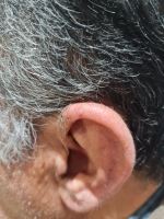 کلینیک شنوایی در اصفهان