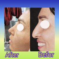 فاطمه قهرمانی