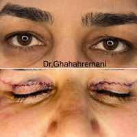 فاطمه قهرمانی