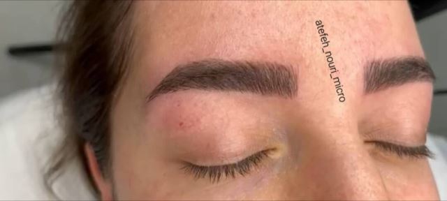 میکروبلیدینگ در شهریار 