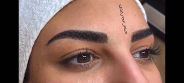 میکروبلیدینگ در شهریار 