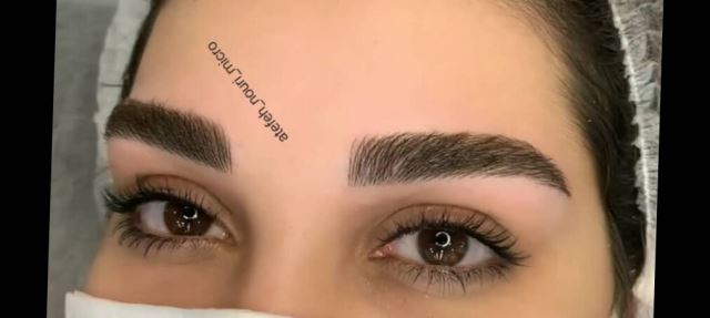 میکروبلیدینگ در شهریار 