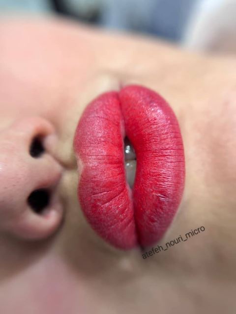 میکروبلیدینگ در شهریار 