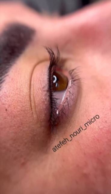 میکروبلیدینگ در شهریار 