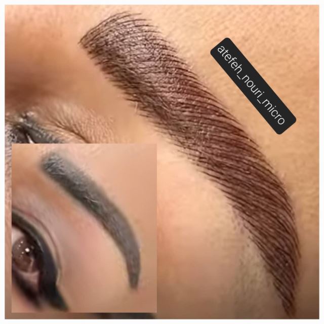 میکروبلیدینگ در شهریار 