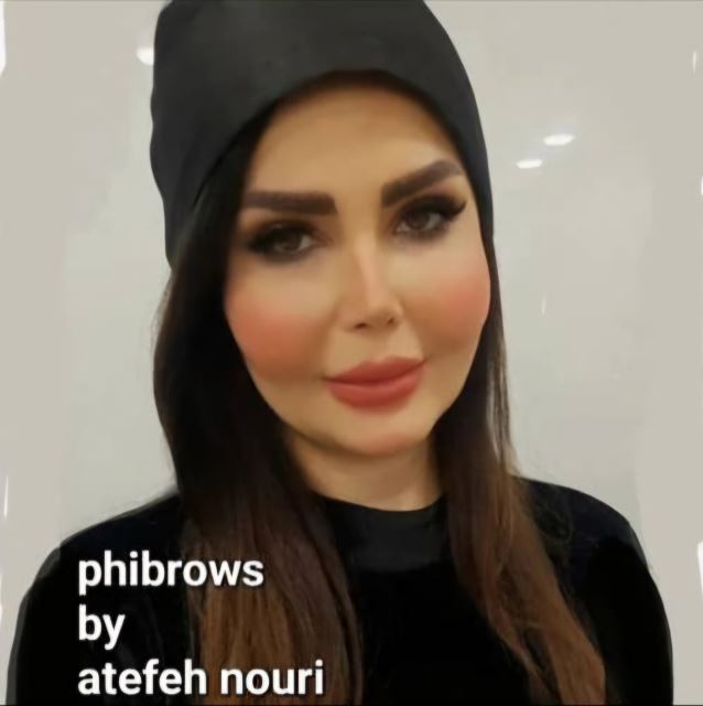 میکروبلیدینگ در شهریار 