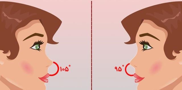 دکتر عمل بینی در کرمانشاه