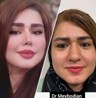 دکتر عمل بینی در کرمانشاه