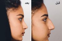 دکتر عمل بینی در کرمانشاه