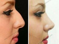 دکتر عمل بینی در کرمانشاه