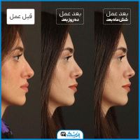 دکتر عمل بینی در کرمانشاه