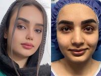 دکتر عمل بینی در کرمانشاه