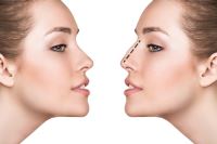 دکتر عمل بینی در کرمانشاه