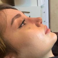 دکتر عمل بینی در تبریز