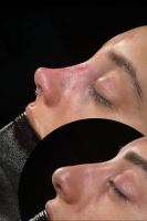 دکتر عمل بینی در تبریز