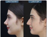 دکتر عمل بینی در تبریز