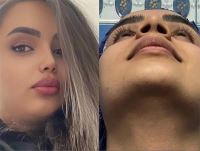 دکتر عمل بینی در تبریز