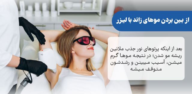 بهترین پزشک لیزر در اصفهان 09136928391