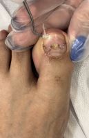 پودولوژی در اصفهان