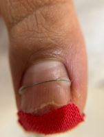 پودولوژی در اصفهان