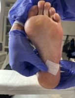 پودولوژی در اصفهان