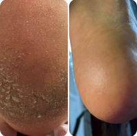 پودولوژی در اصفهان