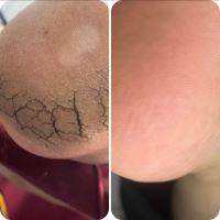 پودولوژی در اصفهان