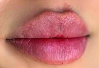 بهترین کلینیک تزریق ژل در قائمشهر