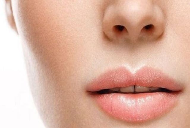 تزریق ژل لب روسی در قائمشهر 