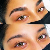 بهترین کلینیک لیفت ابرو با نخ در قائمشهر